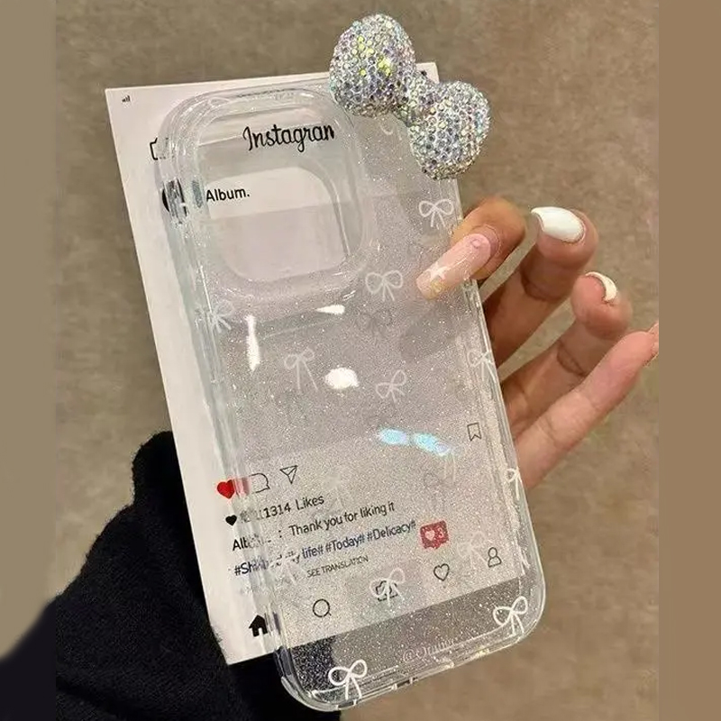เคสโทรศัพท์หรูหราแบบผงวิบวับ 3 - Luxury Watch Case บทวิจารณ์และราคา