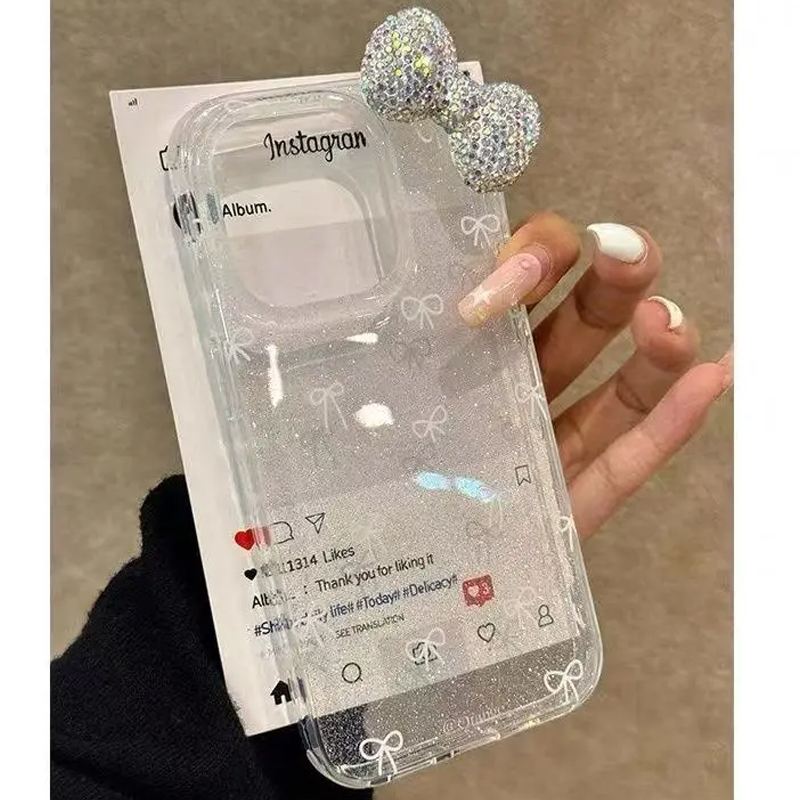 เคสโทรศัพท์หรูหราแบบผงวิบวับ 3 - Luxury Watch Case บทวิจารณ์และราคา